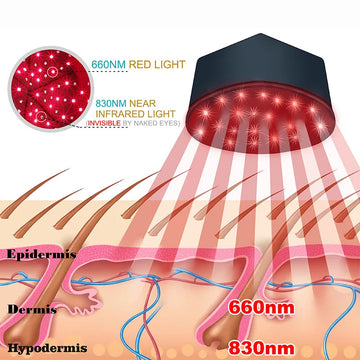 Rode Licht Therapie - Hoed - Nabij Infrarood LED - Haargroei Stimulatie - Haarverlies Preventie - Voor Gebruikers Apsilon
